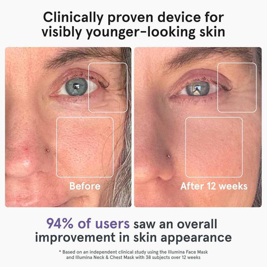 iRestore LED Face Mask – 360‑LED Red, Blue & Infrared Light Therapy for Wrinkles, Dark Spots & Skin Rejuvenation